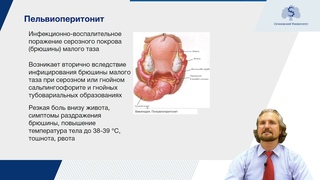 Воспалительные заболевания женских половых органов