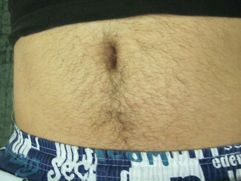 Виктор Ишунин | Великие Луки