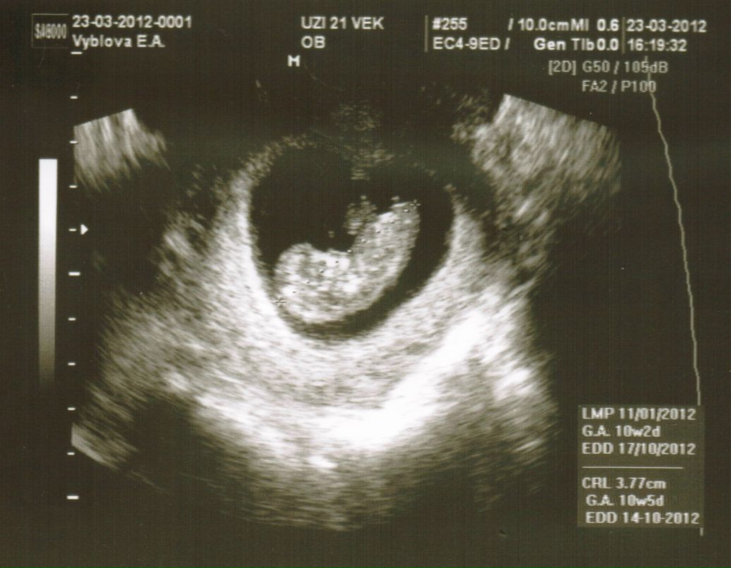 Алексей Лобанов | Санкт-Петербург