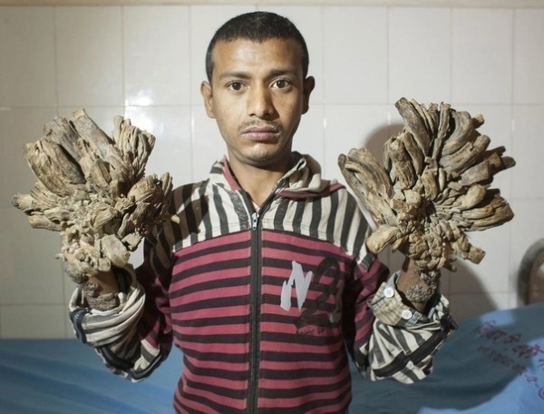 В Бангладеш живёт парень по имени Абдул Бажандар. Он...